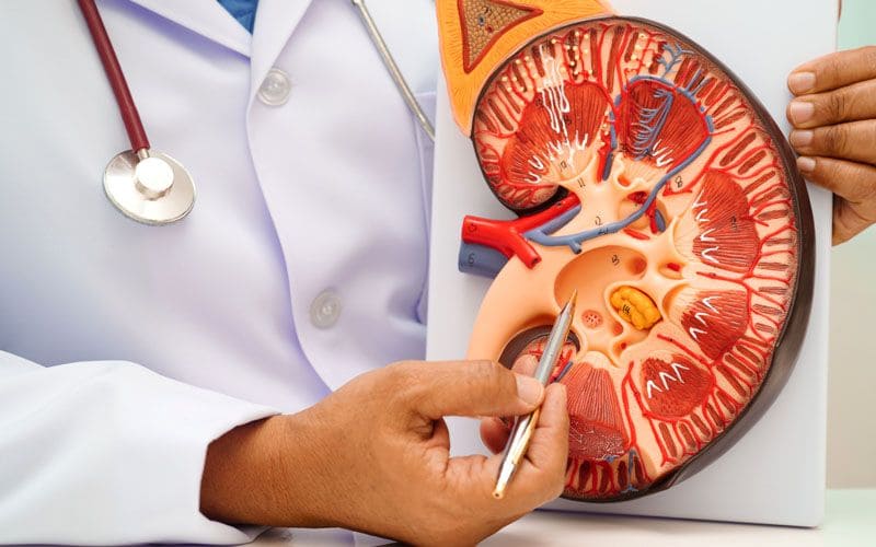 Kidney Stone Treatment – Expert Diagnosis & Advanced Stone Removal in Lucknow
